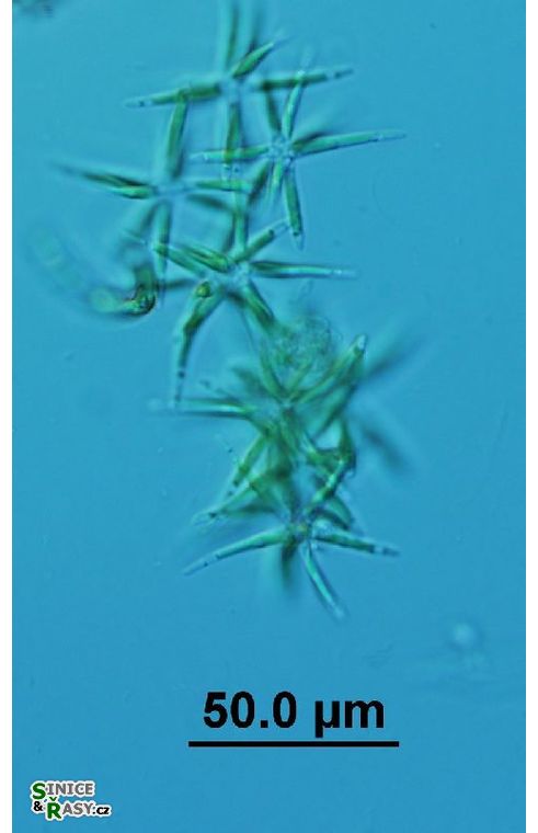 Actinastrum hantzschii
