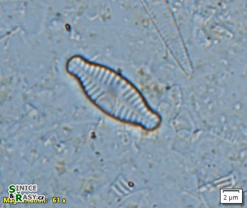 Planothidium amphibium