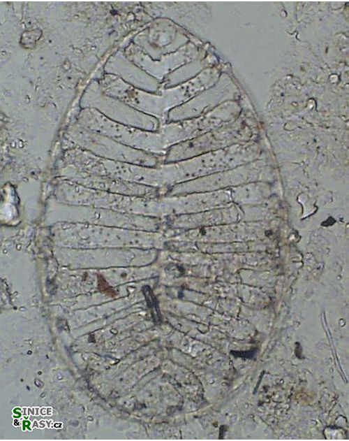 Surirella robusta