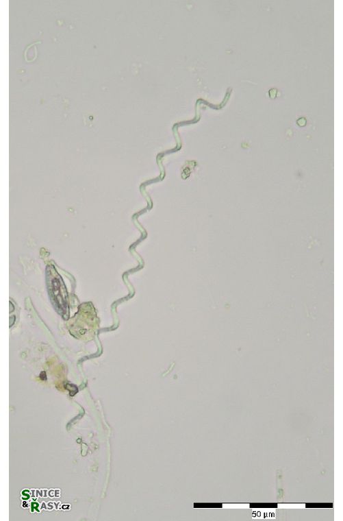 Glaucospira laxissima