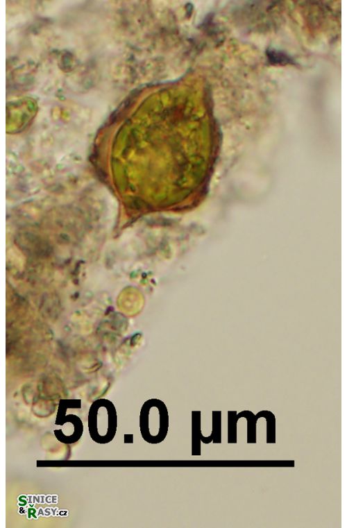 Strombomonas acuminata