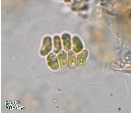 Scenedesmus obtusus var. disciformis