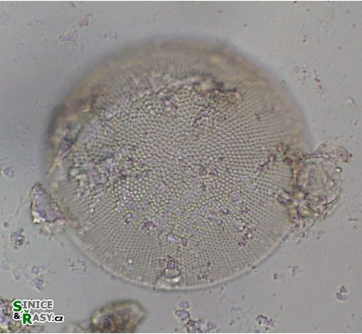 Actinocyclus