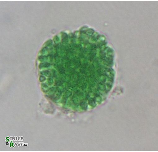 Cyanosarcina
