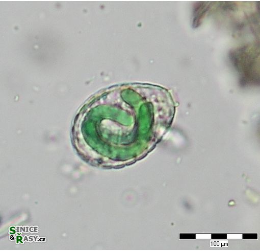 Paulinella chromatophora