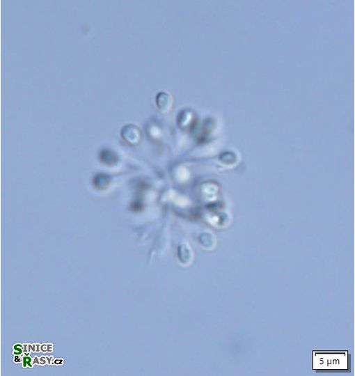Snowella lacustris
