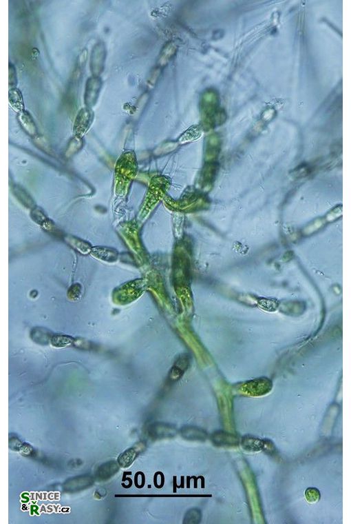 Aphanochaete sp.