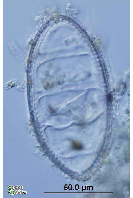 Cymatopleura elliptica
