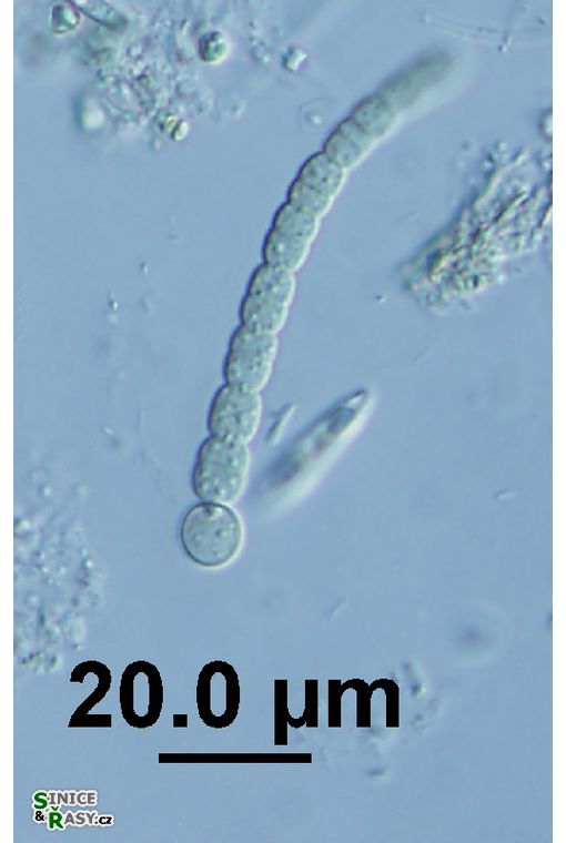 Gloeotrichia sp.