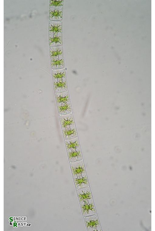 Zygnema