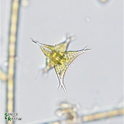 Staurastrum subcruciatum