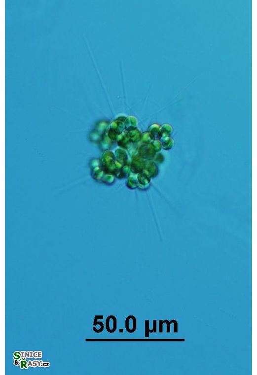 Micractinium crassisetum
