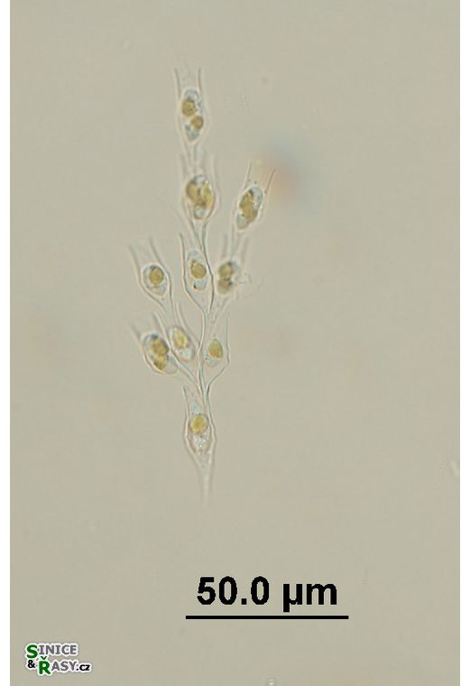 Dinobryon divergens