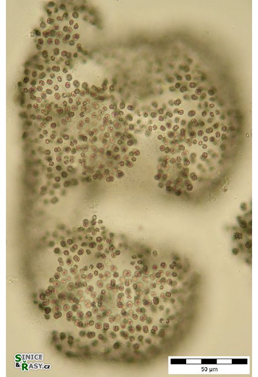 Microcystis flos-aquae