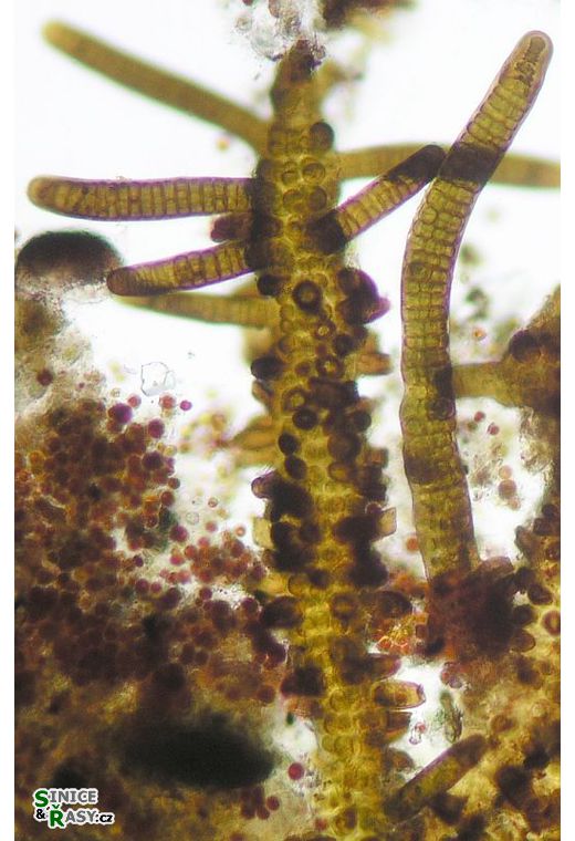 Stigonema mamillosum