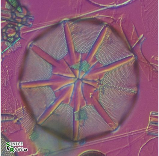 Asteromphalus