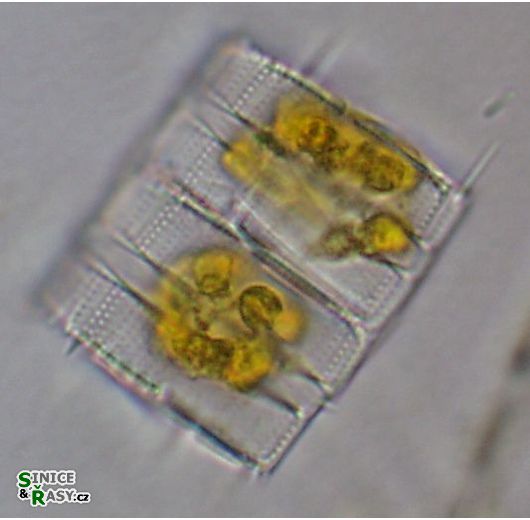 Aulacoseira muzzanensis