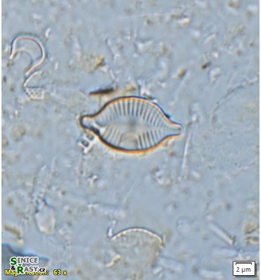 Skabitchewskia peragalloi