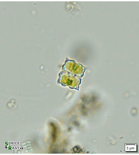 Cosmarium dilatatum