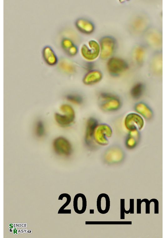 Kirchneriella obesa