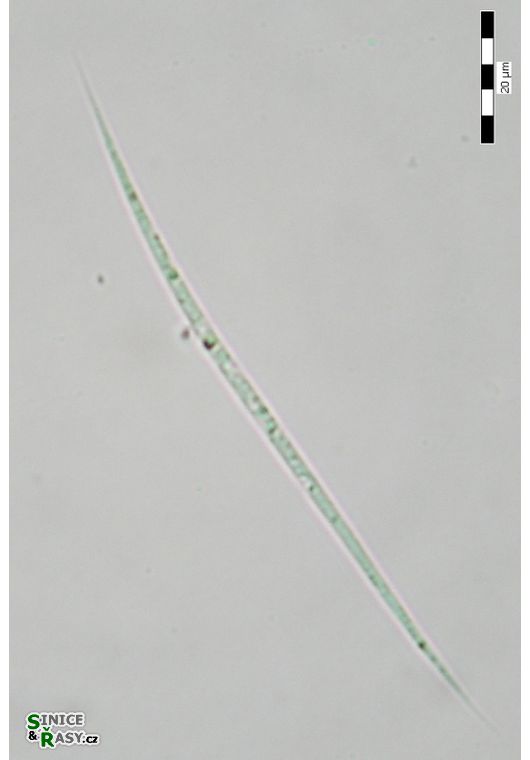 Monoraphidium komarkovae