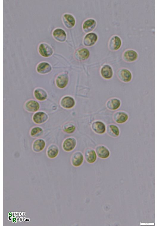Hindakia tetrachotoma