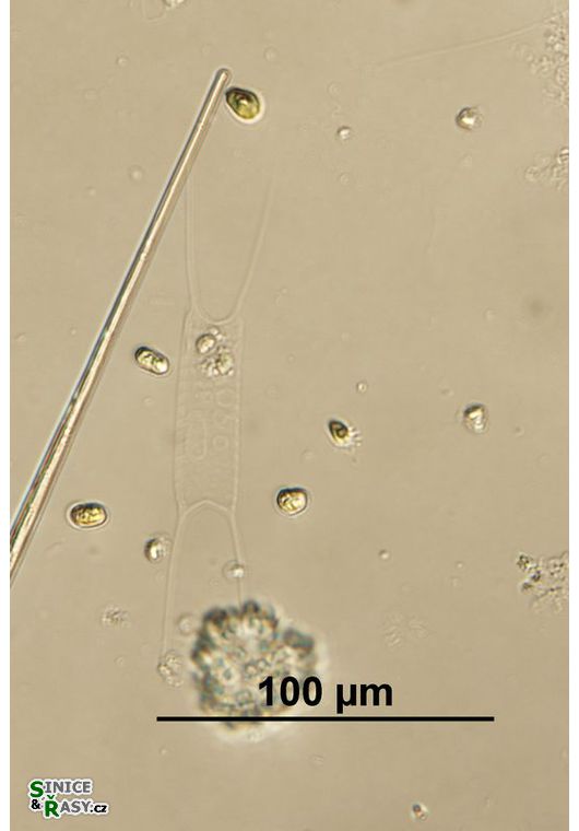 Acanthoceras zachariasii