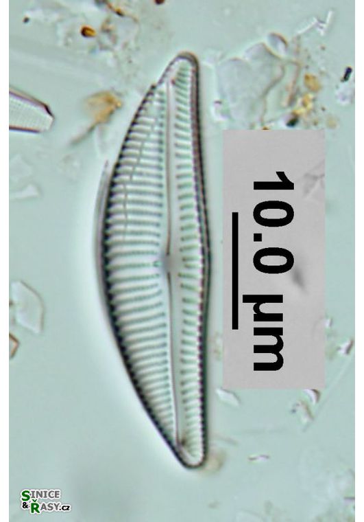 Encyonema elginense