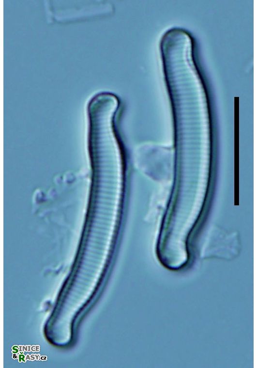 Eunotia exigua