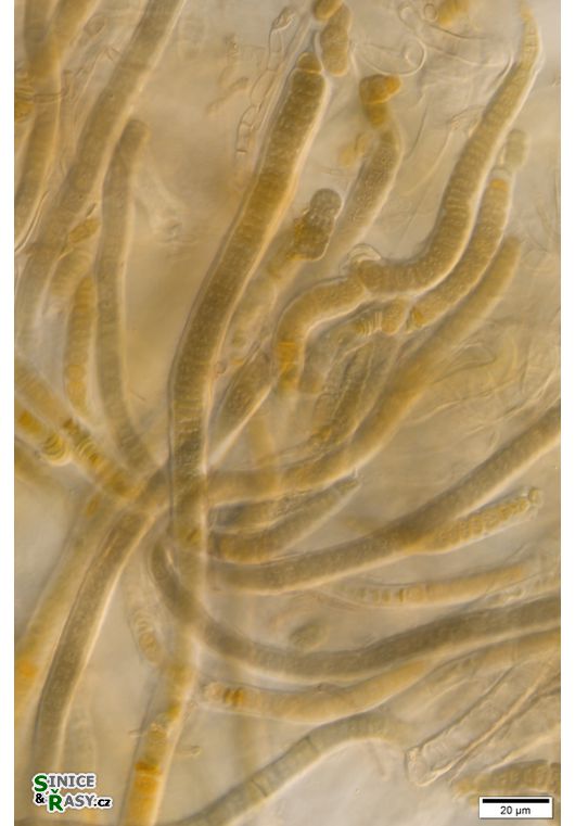 cf. Scytonematopsis