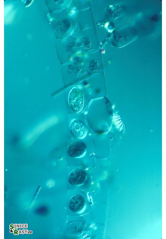 Spirogyra