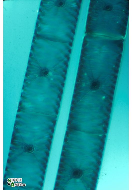 Spirogyra