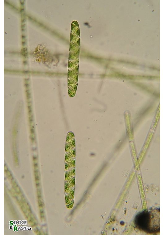 Spirotaenia condensata