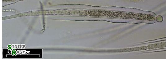 Gloeotrichia intermedia