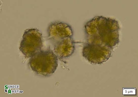 Botryococcus terribilis