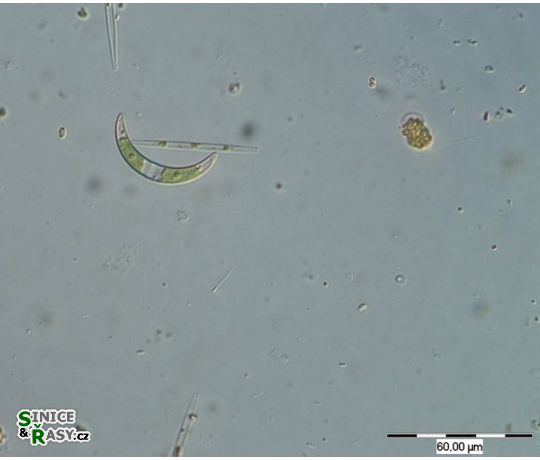 Closterium incurvum