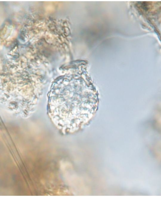 Urceolus macromastix
