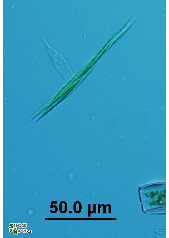 Monoraphidium griffithii 