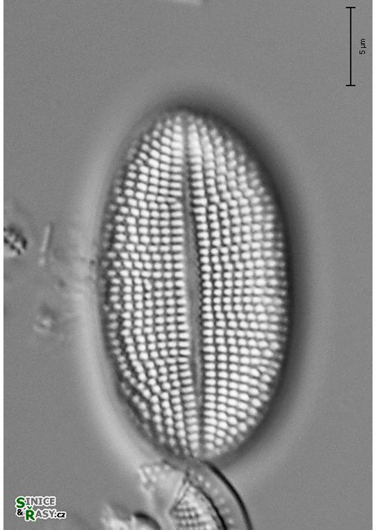 Cocconeis placentula