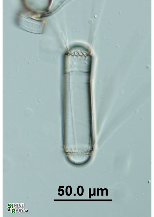 Corethron hystrix