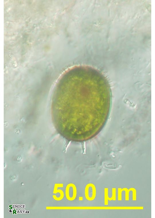 Trachelomonas armata