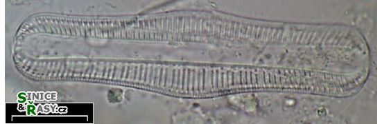 Rhopalodia gibba