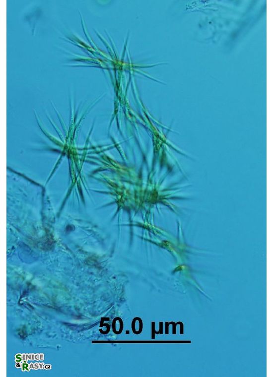 Ankistrodesmus falcatus