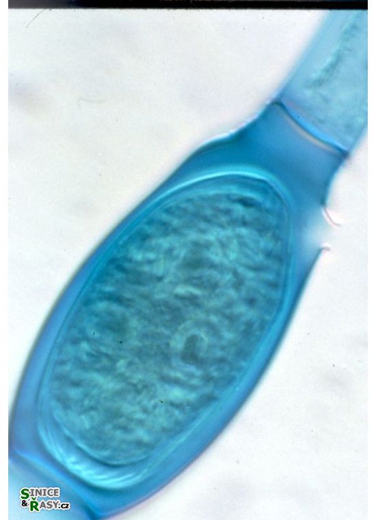 Oedogonium