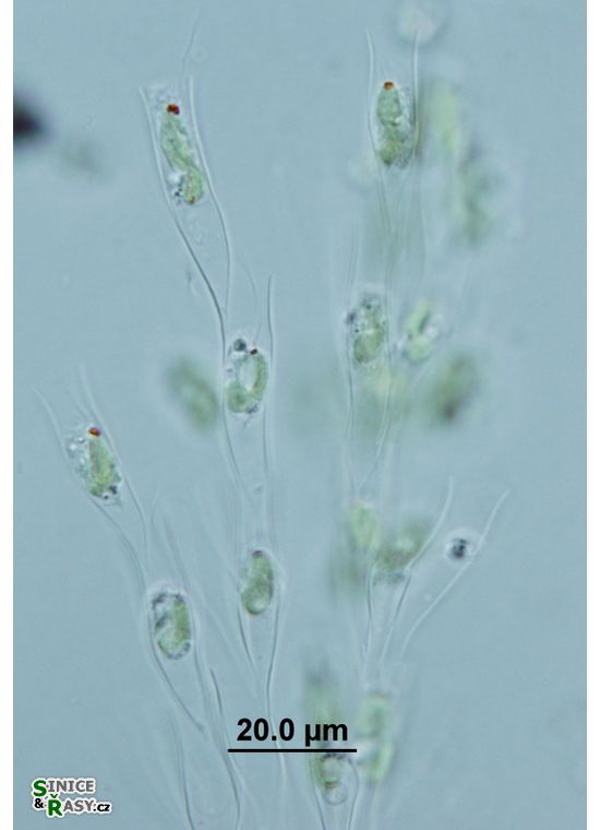 Dinobryon sertularia