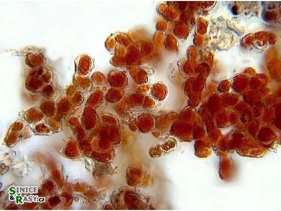 Trentepohlia umbrina
