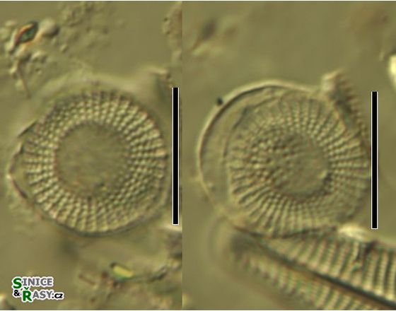 Stephanodiscus medius
