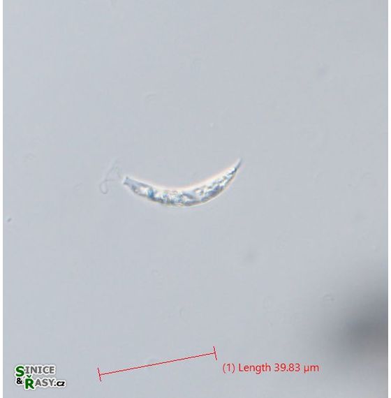 Astasia curvata