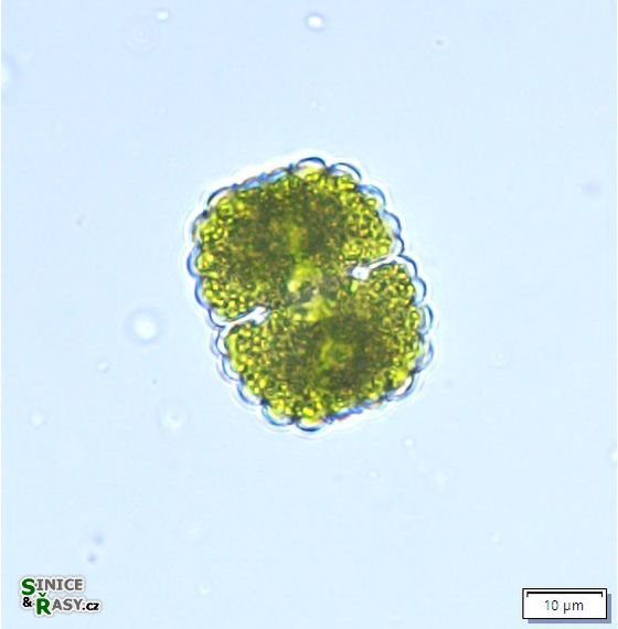 Cosmarium crenatum
