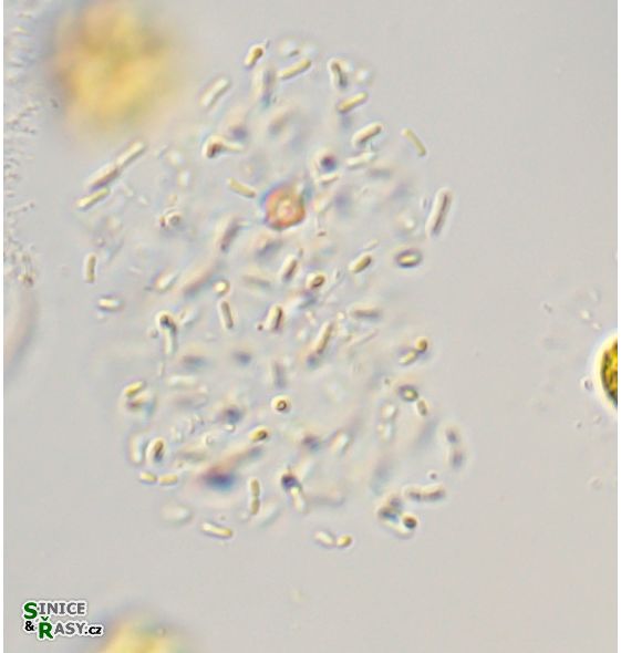 Cyanodictyon planctonicum